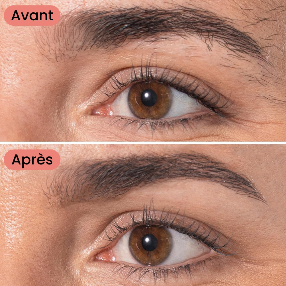 Stylo d’Épilation Ultra-Précis